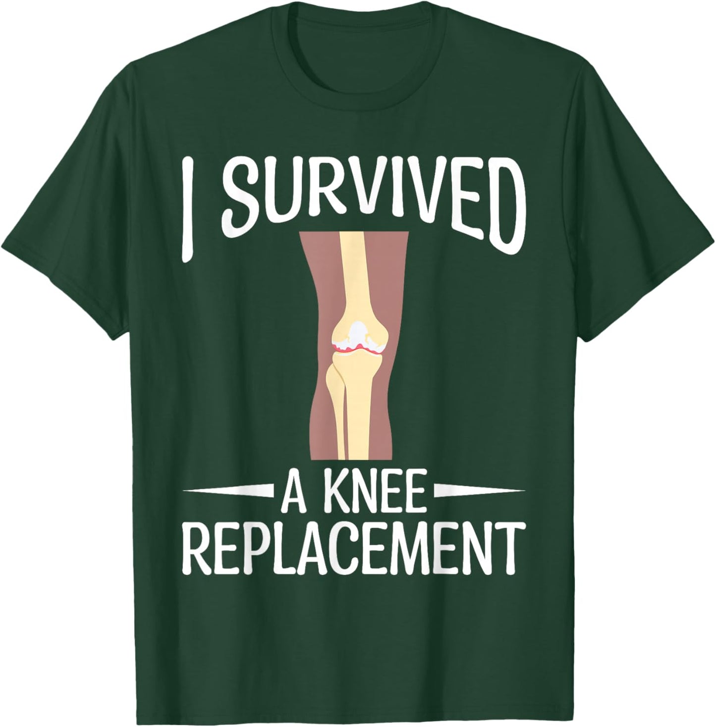 Knee Replacement Surgery - I Survived A Knee Replacement T-Shirt - T-Shirt | Forest
