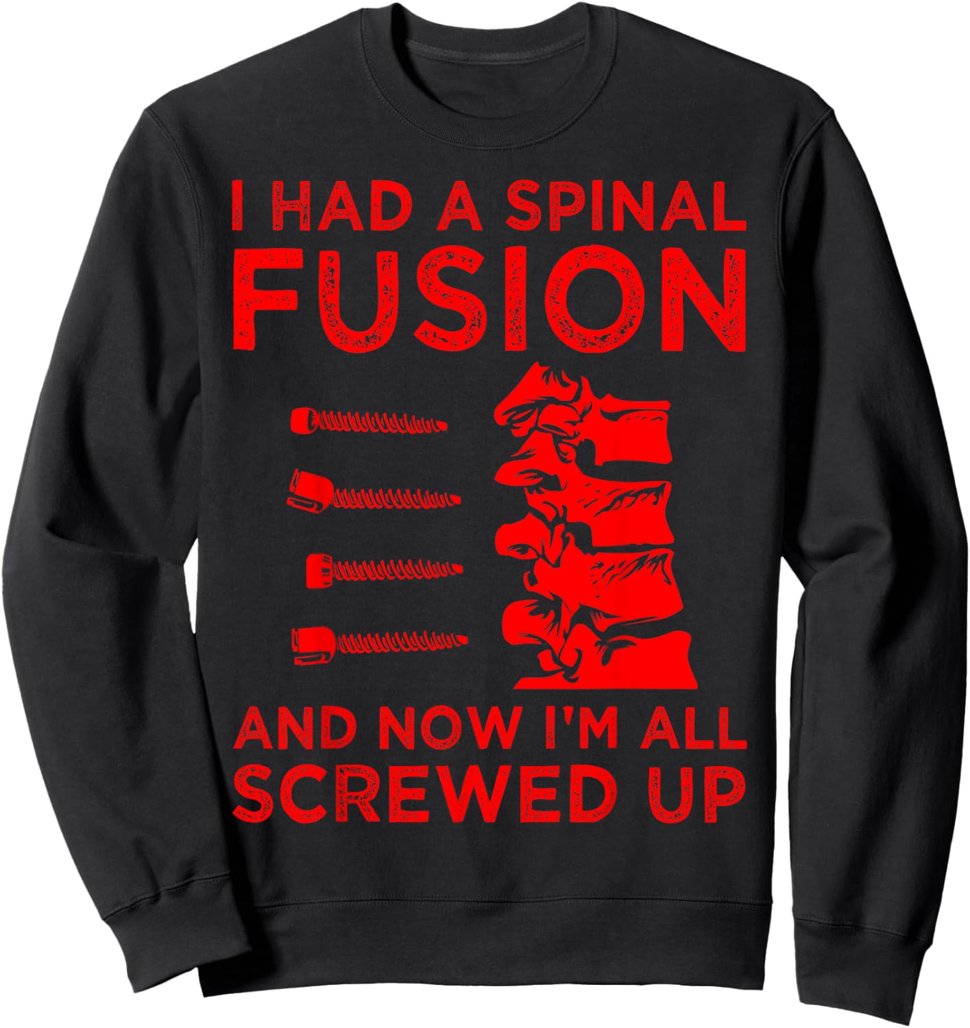 Cool Scoliosis Spinal Fusion Gift Back Surgery Recovery Gift Sweatshirt - Sweatshirt | Black