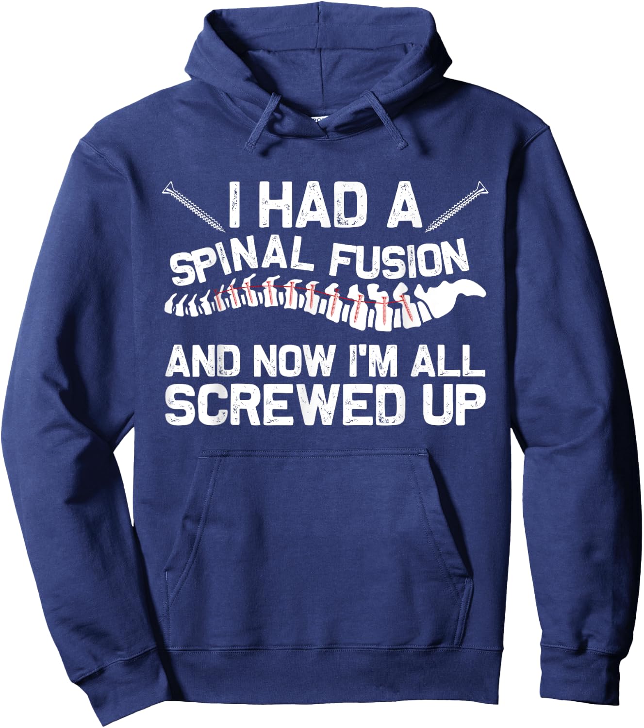 Cool Scoliosis Spinal Fusion Gift Back Surgery Recovery Gift Hoodie - Hoodie | Navy