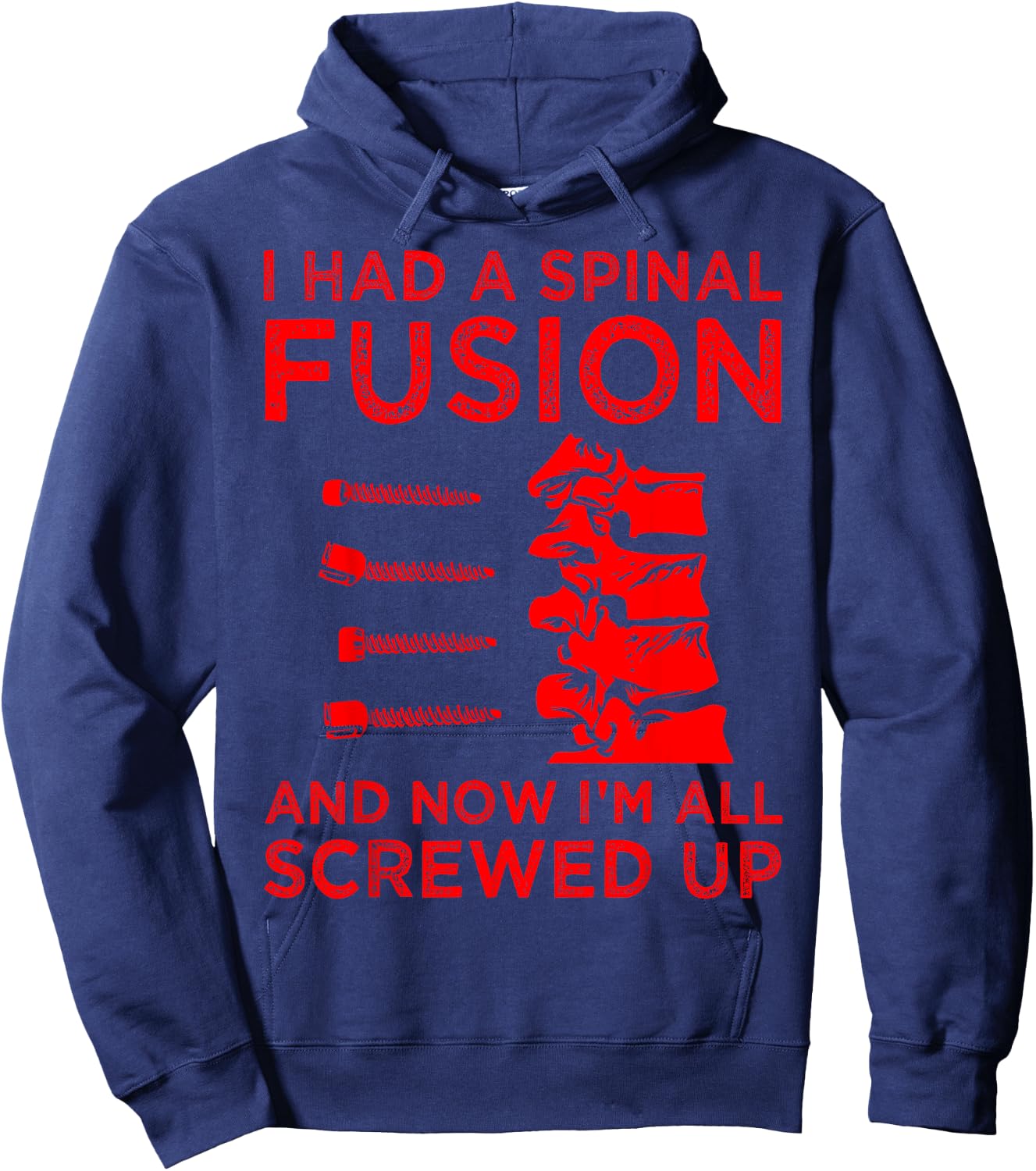 Cool Scoliosis Spinal Fusion Gift Back Surgery Recovery Gift Hoodie - Hoodie | Navy