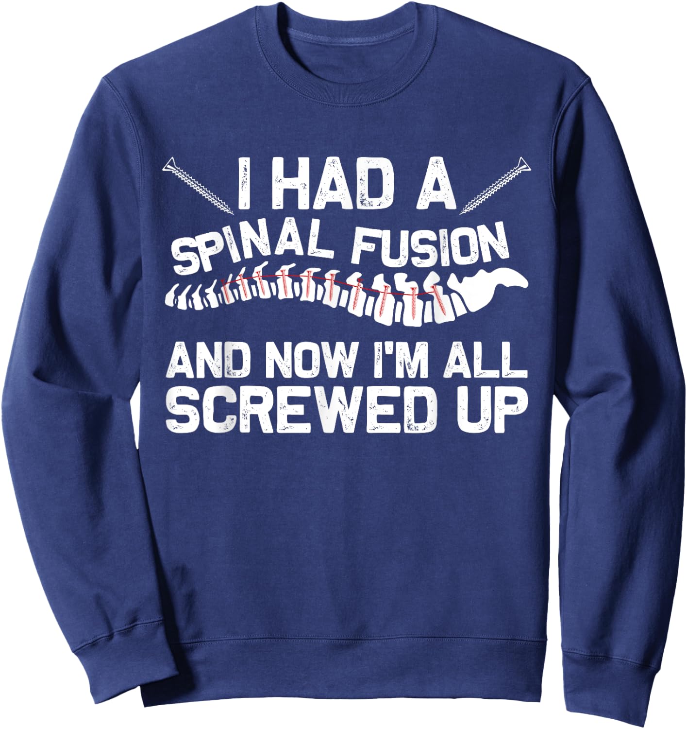 Cool Scoliosis Spinal Fusion Gift Back Surgery Recovery Gift Sweatshirt - Sweatshirt | Navy