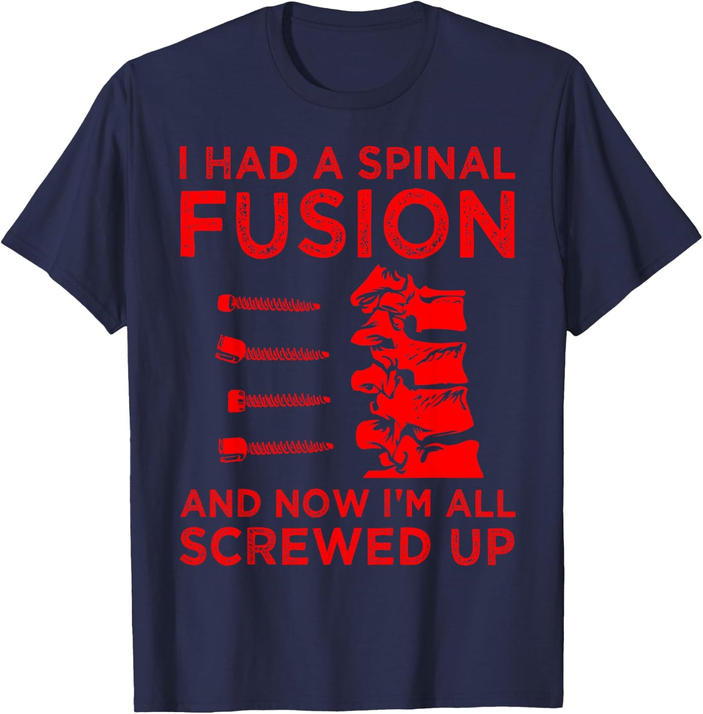 Cool Scoliosis Spinal Fusion Gift Back Surgery Recovery Gift T-Shirt - T-Shirt | Navy