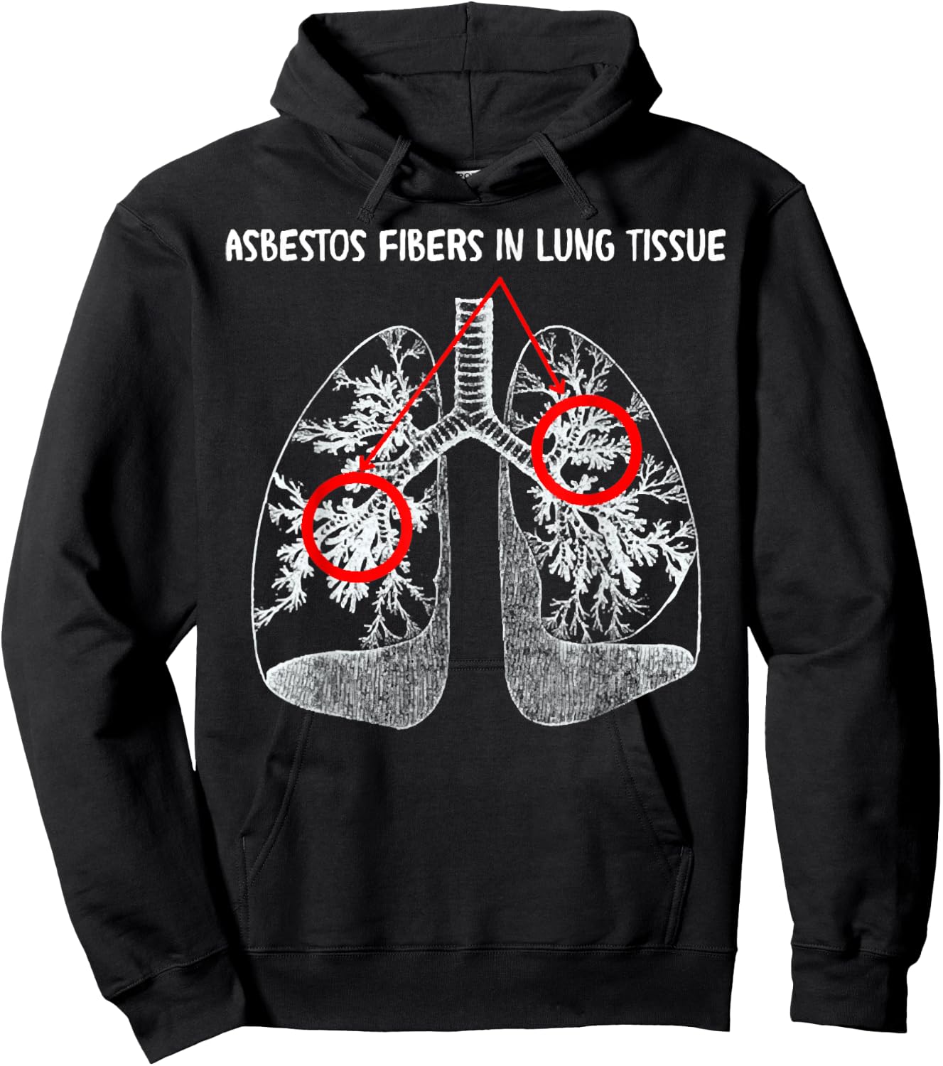 Asbestos Fibers In Lung Tissue, Respiratory Therapy For Lung Hoodie - Hoodie | Black