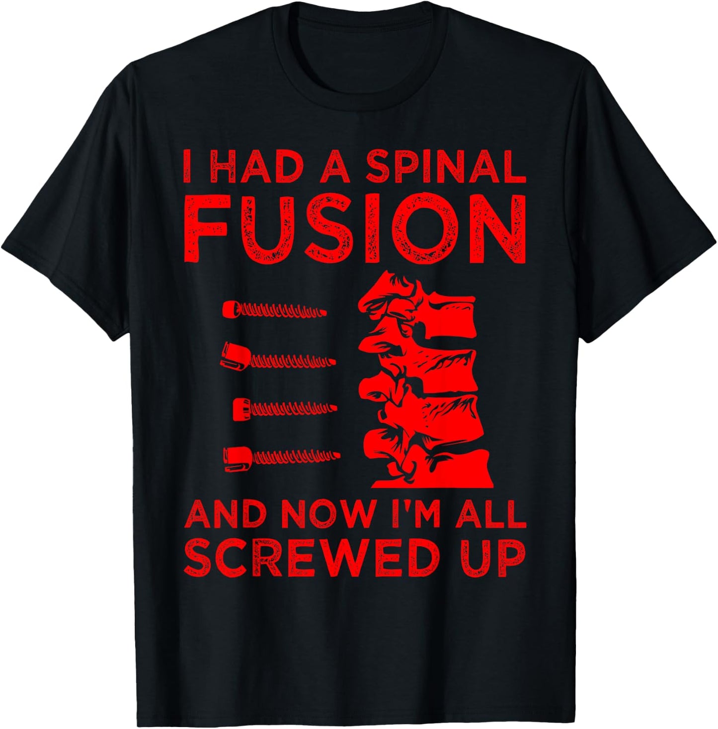Cool Scoliosis Spinal Fusion Gift Back Surgery Recovery Gift T-Shirt - T-Shirt | Black