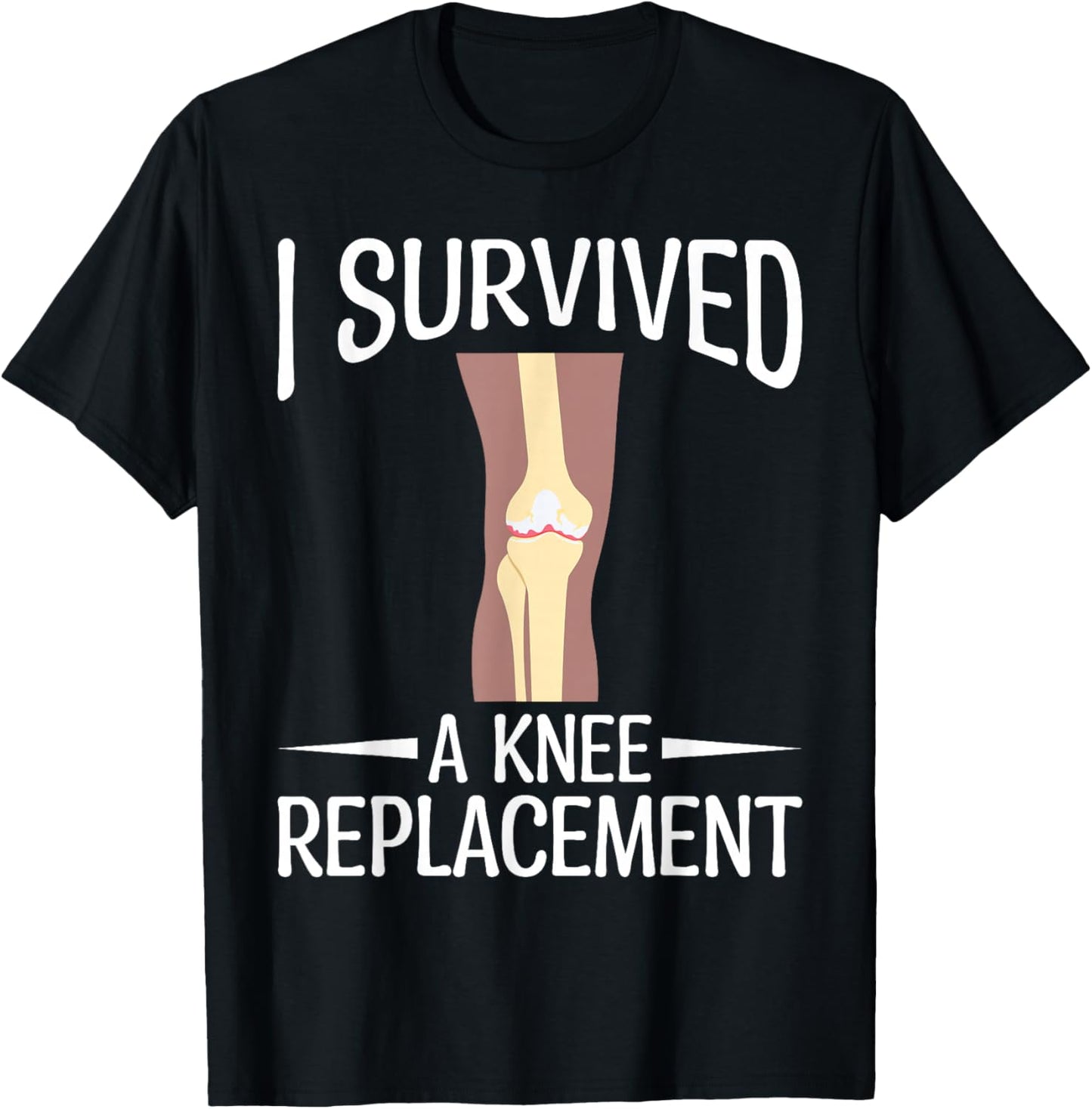 Knee Replacement Surgery - I Survived A Knee Replacement T-Shirt - T-Shirt | Black